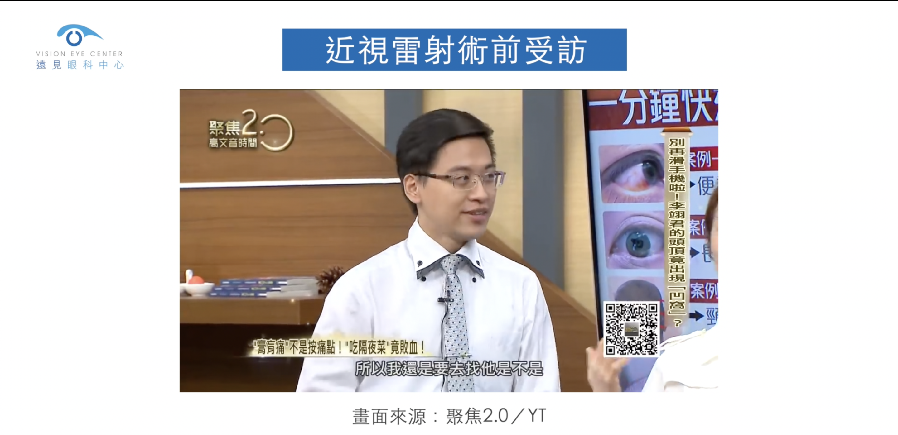 林佑彥醫師進行SMILE全飛秒近視雷射前戴眼鏡的模樣