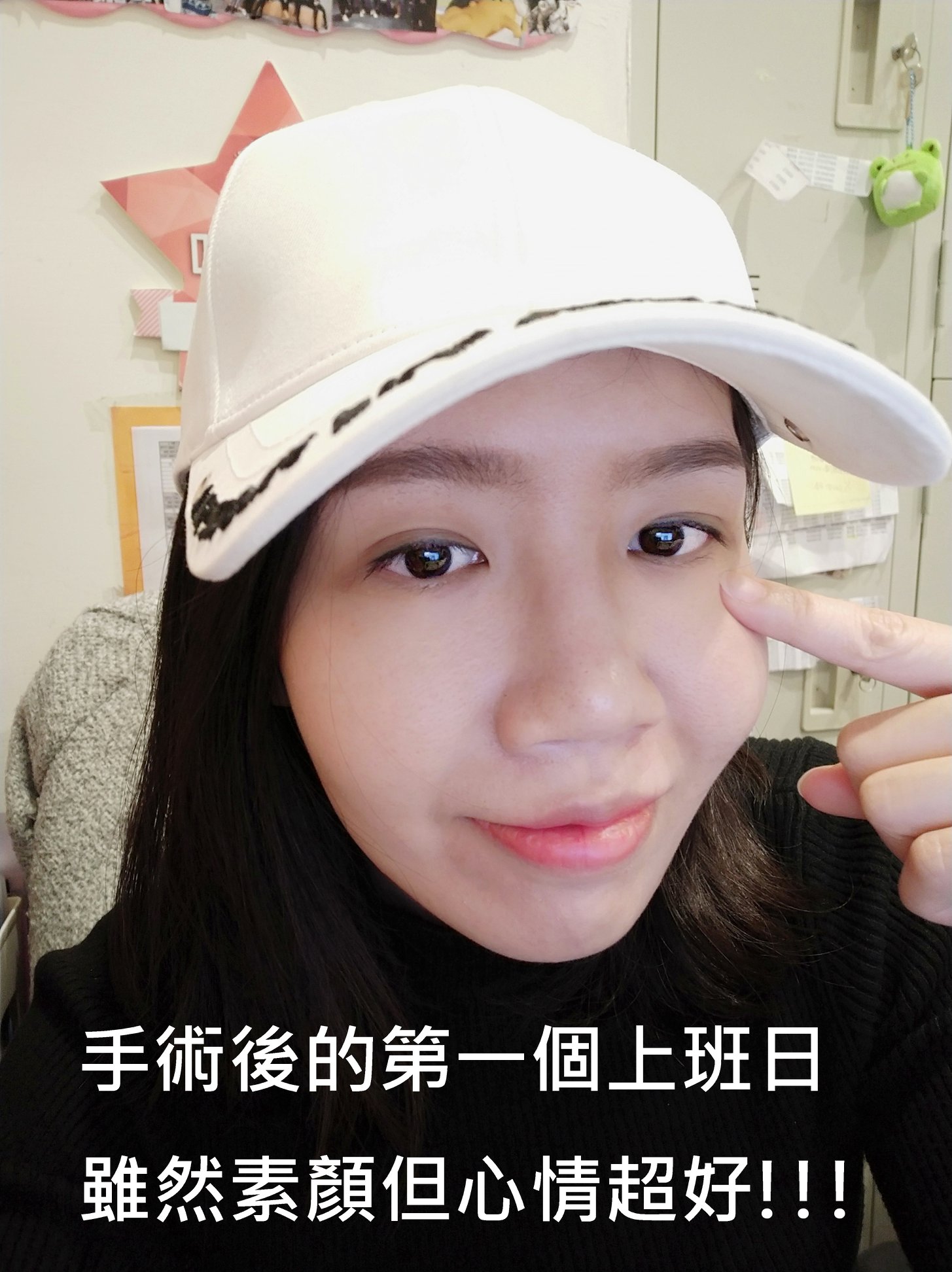 我選擇做 Smile全飛秒近視雷射 安全考量當然是第一 加上又是最新的技術，修復期短好照顧，都是擄獲我心的原因。SMILE全飛秒近視雷射術後分享、SMILE pro全飛秒近視雷射術後分享、SMILE pro、visumax 800