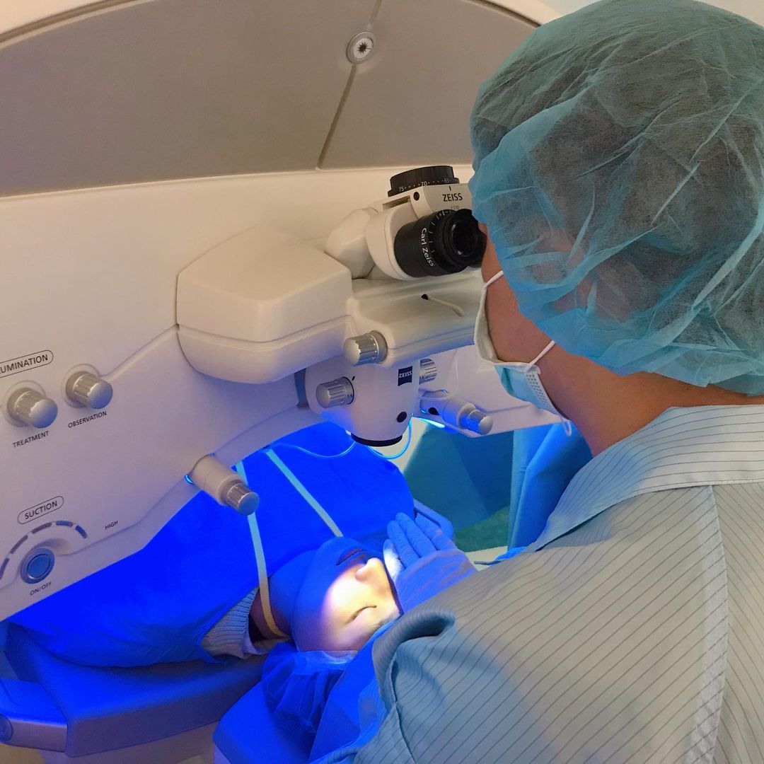 我選擇新的技術SMILE全飛秒近視雷射,別於以往不用掀角膜瓣,SMILE傷口僅2-4mm筆尖般傷口,因為是微創全飛秒手術,所以恢復期較短,而且手術過程一眼也只要大約23秒的時間,十分快速。SMILE全飛秒近視雷射術後分享、SMILE pro全飛秒近視雷射術後分享、SMILE pro、visumax 800