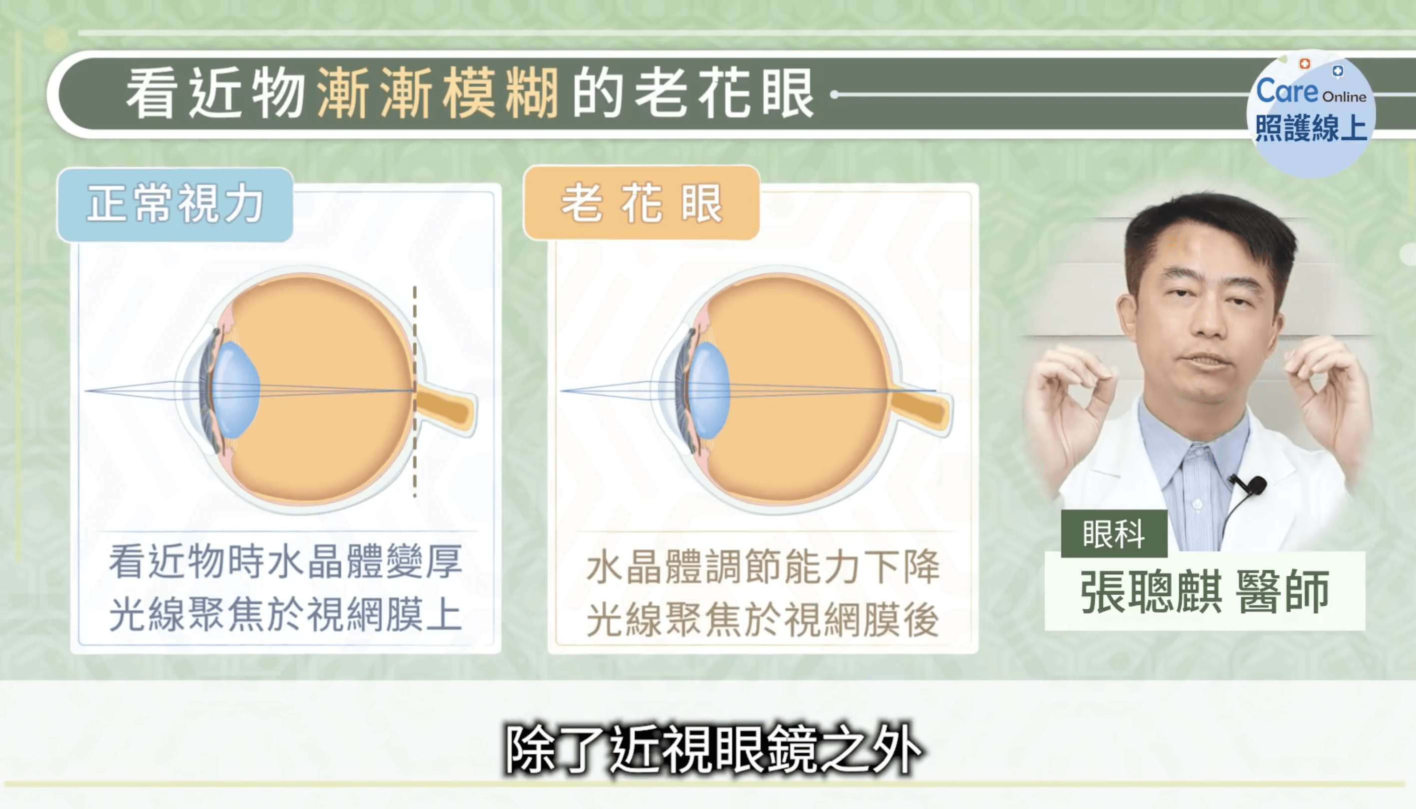 為什麼會出現老花眼？老花眼就是眼睛調節能力，隨著年紀而下降。