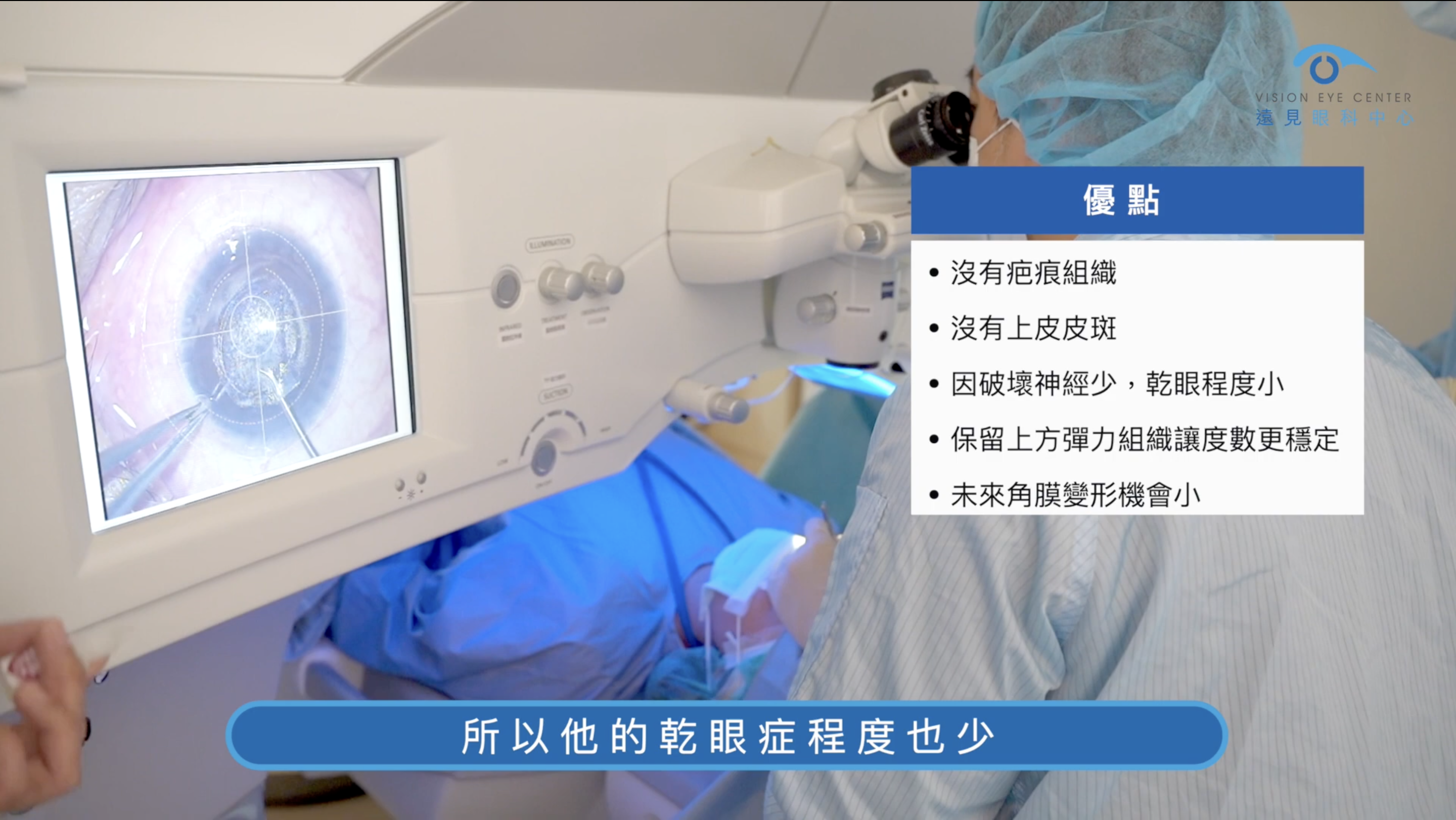 SMILE全飛秒近視雷射手術優點