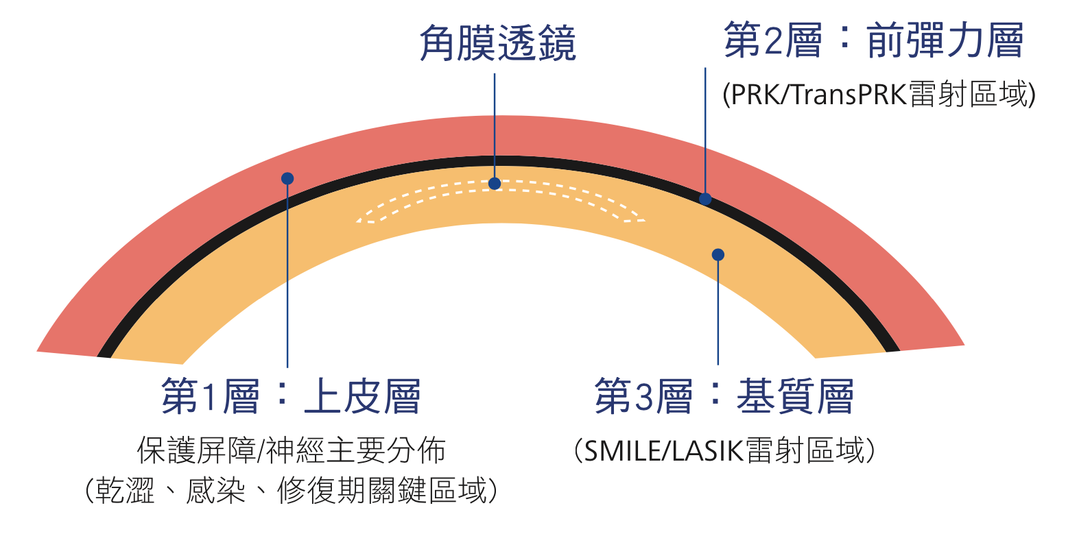 近視雷射作用部位