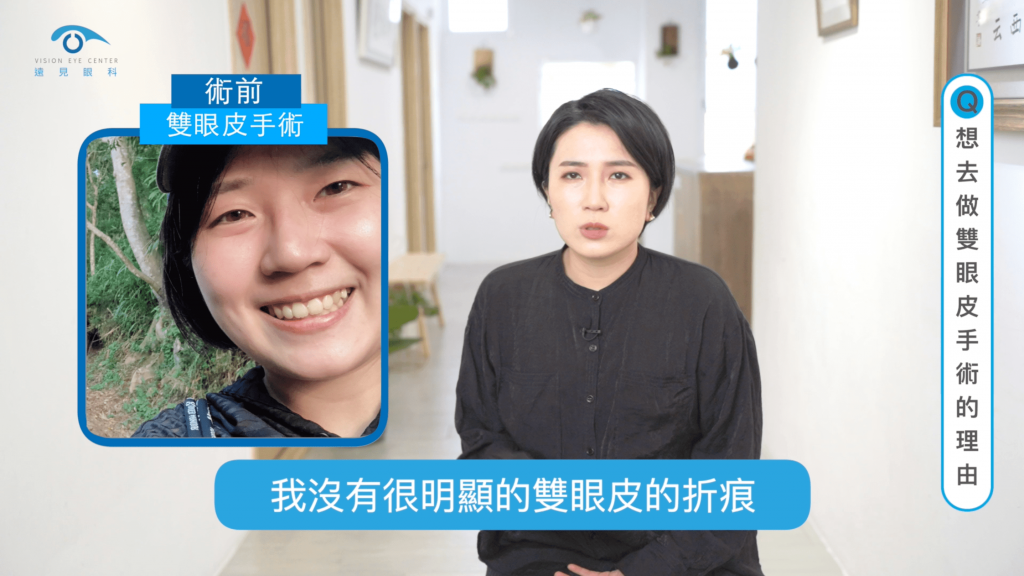 想去做雙眼皮手術的原因