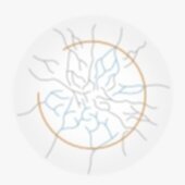 LASIK飛秒製瓣手術傷口