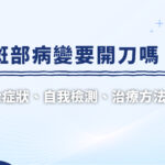 黃斑部病變要開刀嗎？眼科醫師詳解3大症狀、自我檢測、治療方法