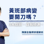 黃斑部病變要開刀嗎？眼科醫師詳解3大症狀、自我檢測、治療方法