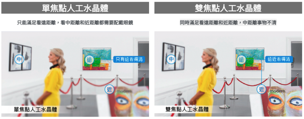 單焦點人工水晶體跟雙焦點人工水晶體