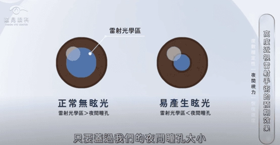 夜間眩光瞳孔變化示意圖