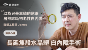 飛秒白內障手術
