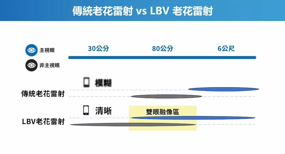 傳統與LBV老花雷射雙眼融像差異示意圖