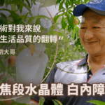 白內障手術心得分享