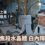 飛秒白內障手術