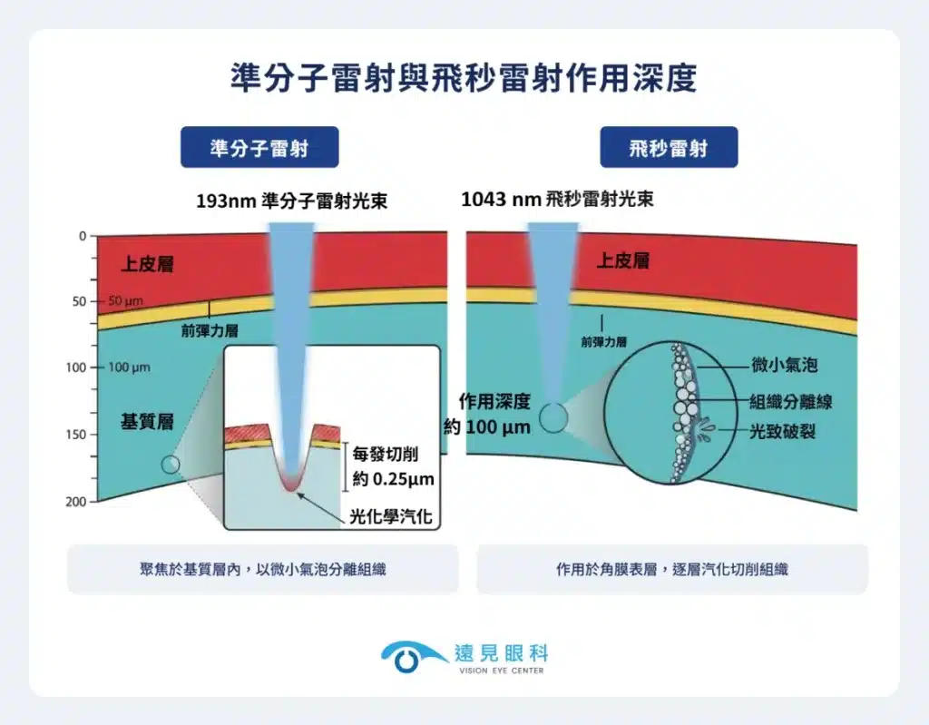 準分子與飛秒雷射作用方式