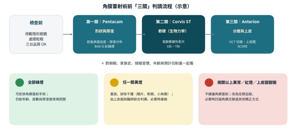 術前三關的判讀流程：先排除干擾，再依序看形狀、軟硬、分層，最後合併對側眼與病史做決定。（示意圖）