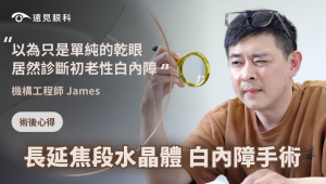 飛秒白內障手術