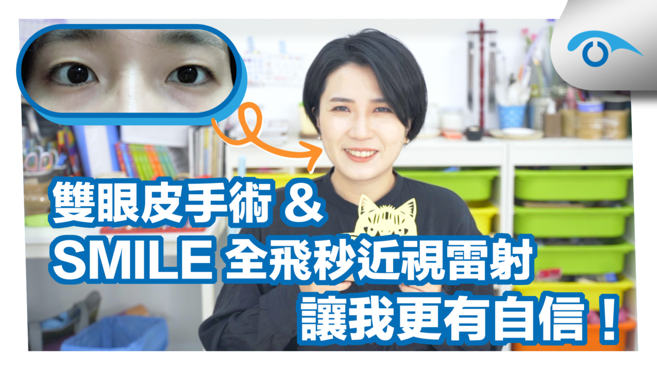 眉靈SMILE近視雷射＆雙眼皮手術