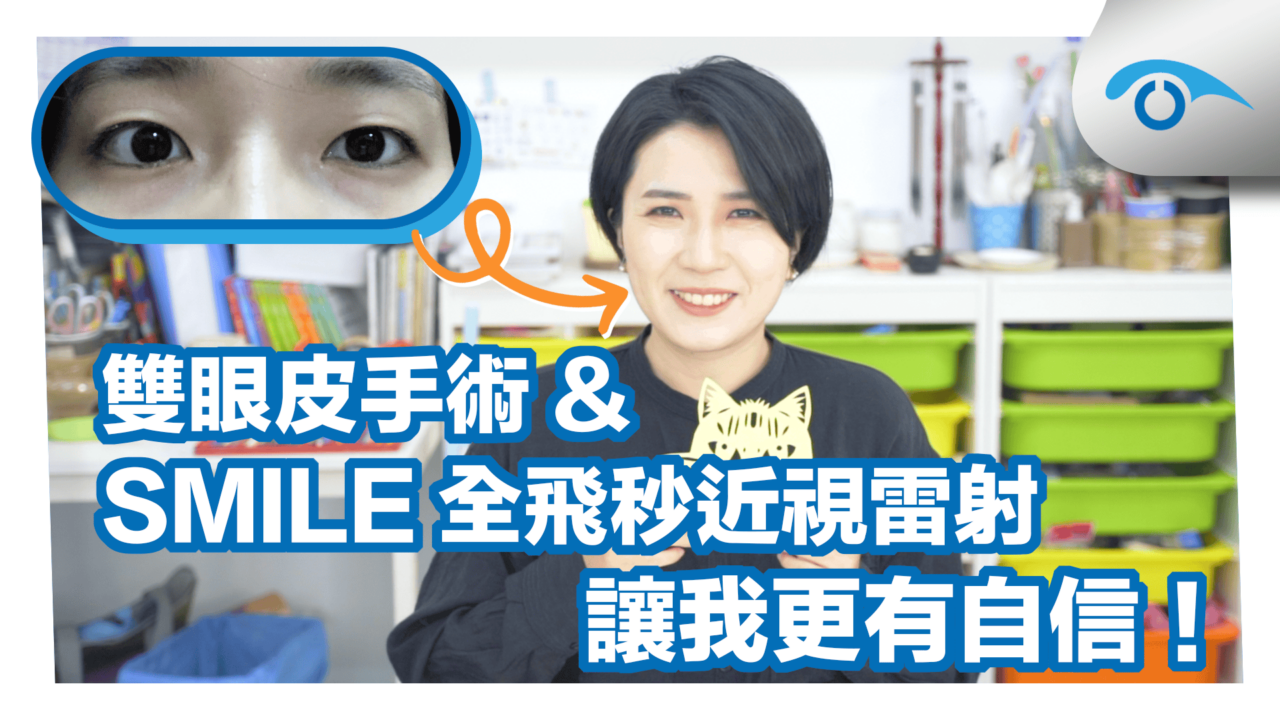 眉靈SMILE近視雷射＆雙眼皮手術