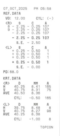 眼睛檢查的驗光單怎麼看